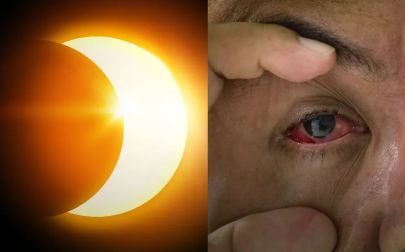 Eclipse
