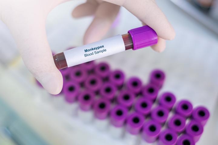 Por: Cortesía Secretaría de Salud emite recomendaciones sobre el Mpox