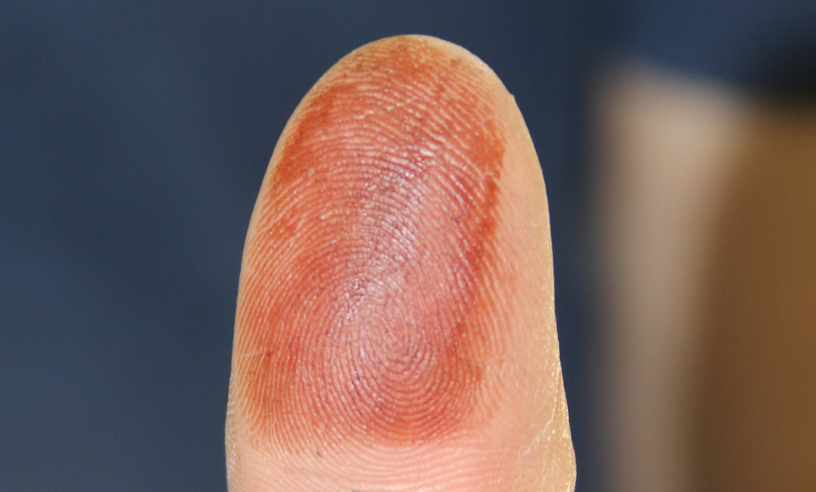 Votarán de forma anticipada personas con impedimento físico