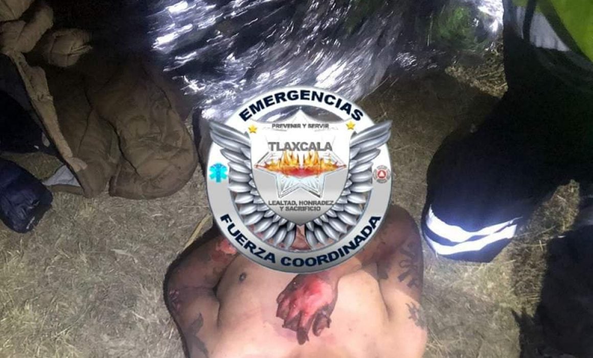 Por: Cortesía Intentan linchar a pareja en Tetlatlahuca; queman a hombre y golpean a mujer