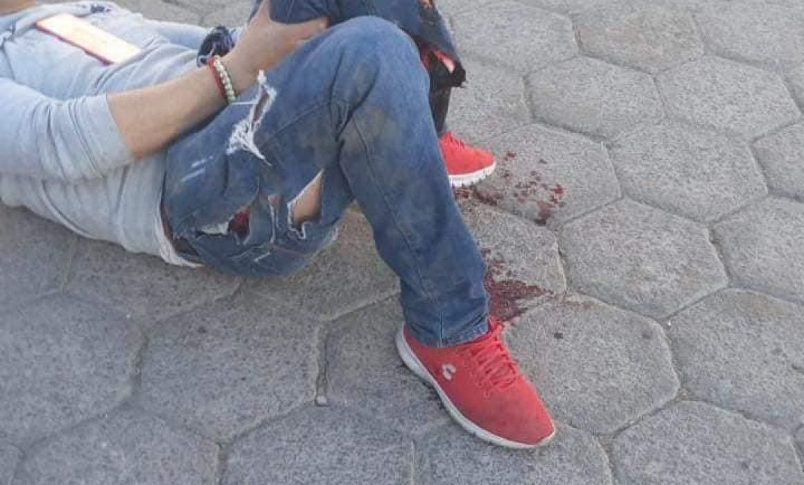 Retroexcavadora atropella a un hombre en Zacatelco