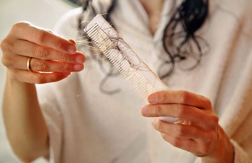 Por: Cortesía Biotina: La Vitamina Esencial para Combatir la Caída del Cabello y Fortalecer tu Salud