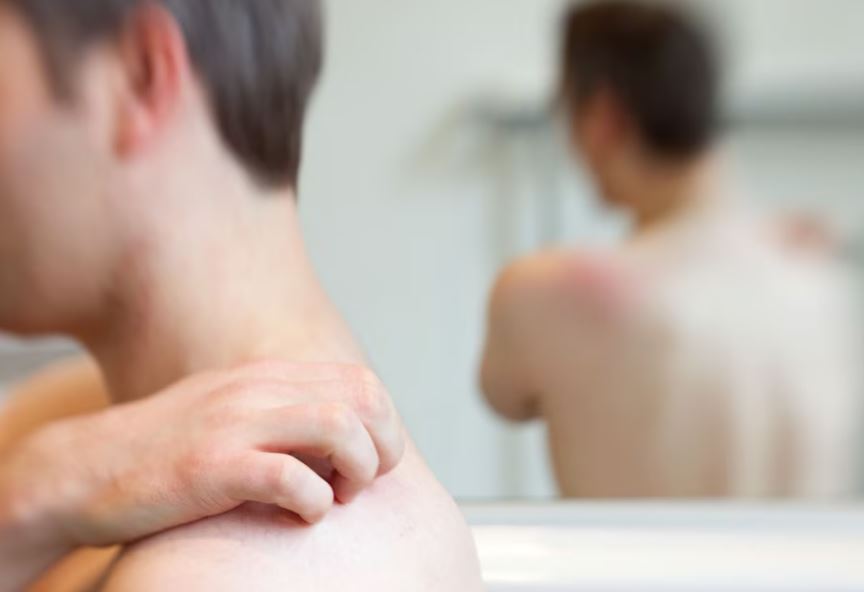 Por: Cortesía Polvo pica pica: ¿qué lo hace irritante y cómo aliviar la picazón?