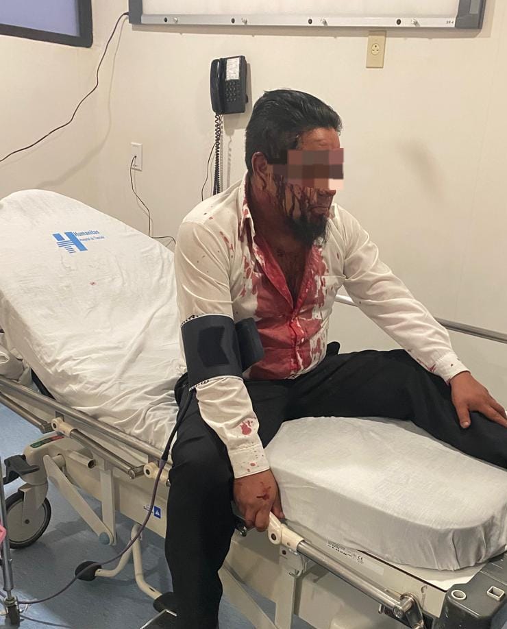 Por: Cortesía Asaltan con violencia a chofer de unidad de transporte público de la ruta Miraflores en Tlaxcala