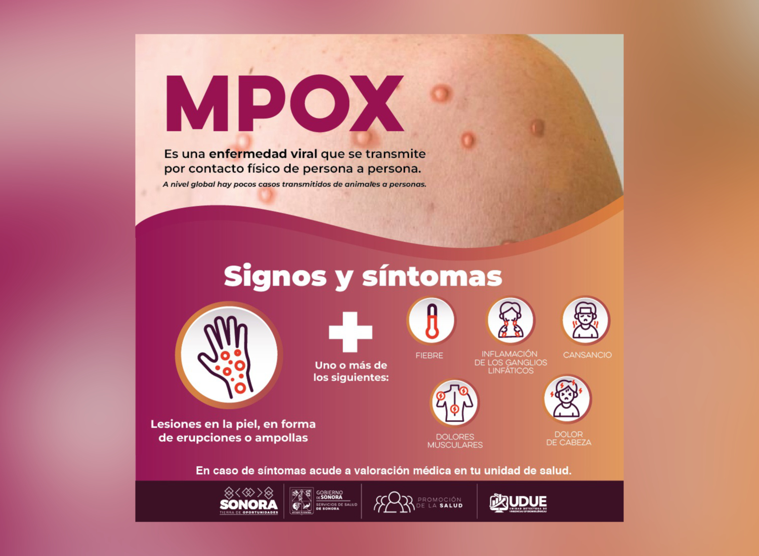 Por: Cortesía Secretaría de Salud capacita a profesionales para enfrentar mpox: prevención y diagnóstico clave
