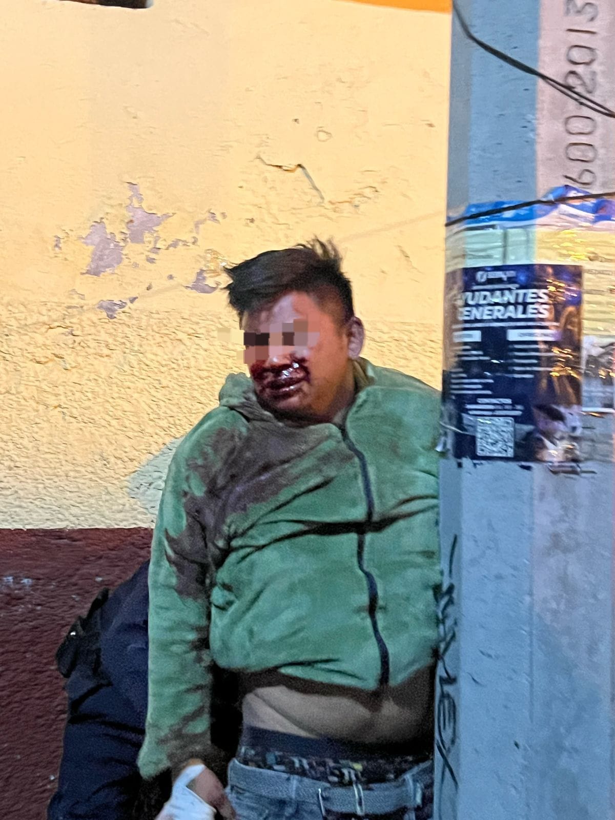 Intento de robo en San Pablo del Monte termina con golpiza vecinal: sorprenden a sujeto robando batería de auto