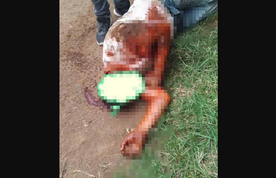Foto: Cortesía Hombre resulta gravemente herido por ataque de pitbull en Zacatlán