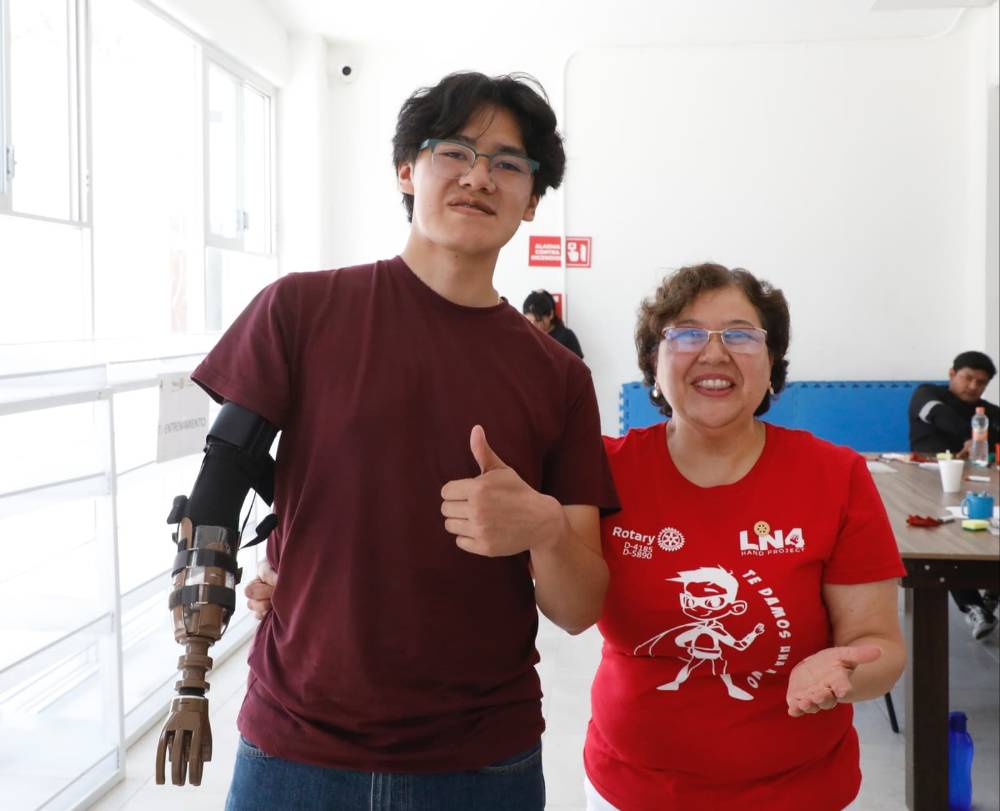 Prótesis de mano cambian vidas en Tlaxcala: esperanza y movilidad