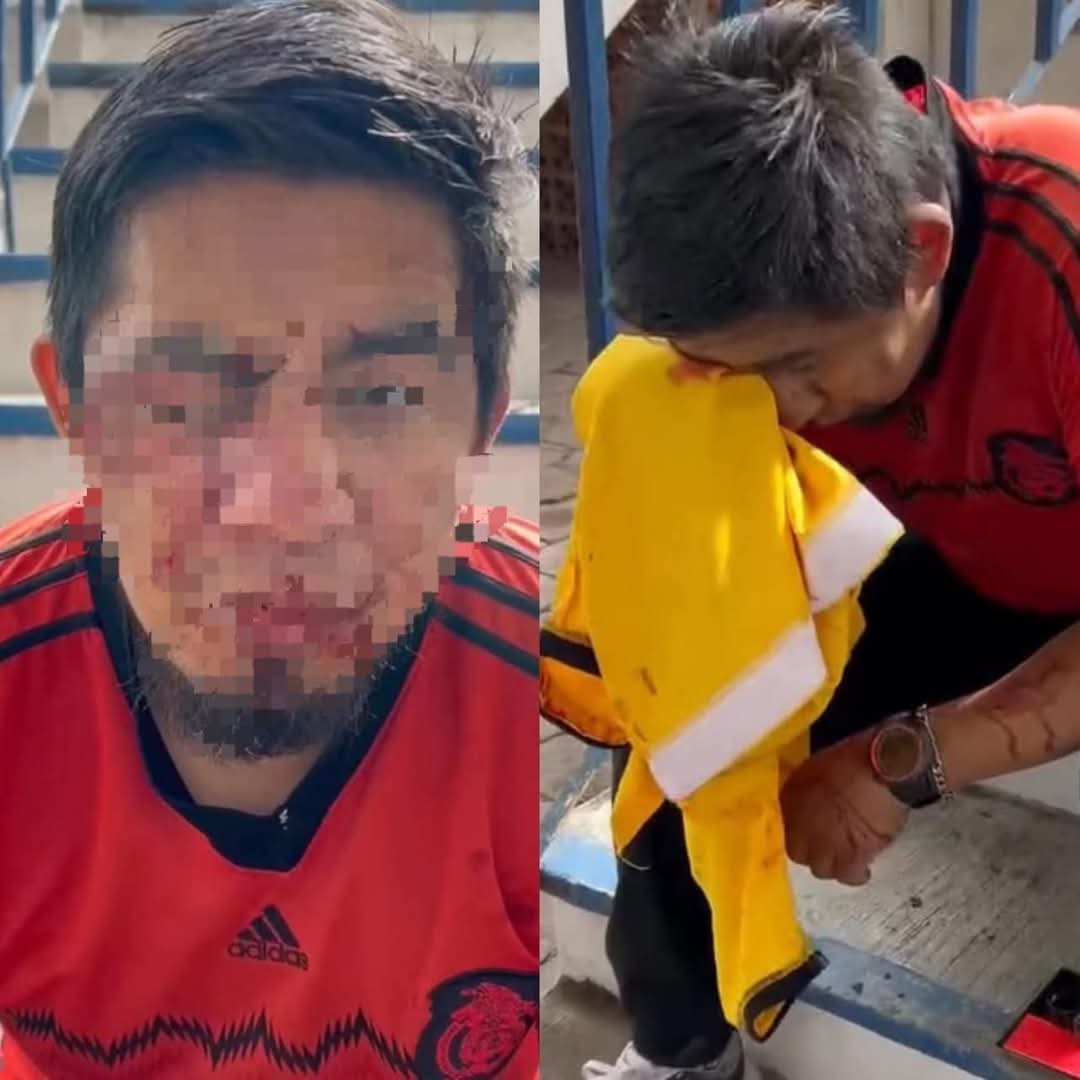 Arbitro denuncia ante FGJE tras ser agredido en partido local