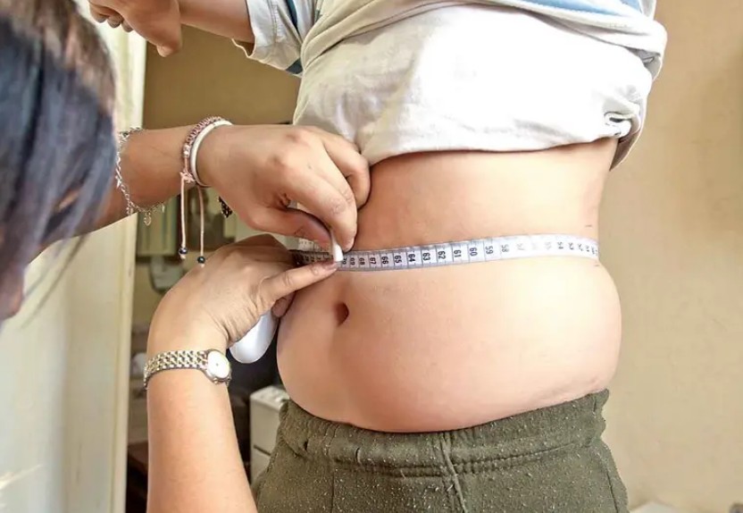 Obesidad reduce la esperanza de vida en México