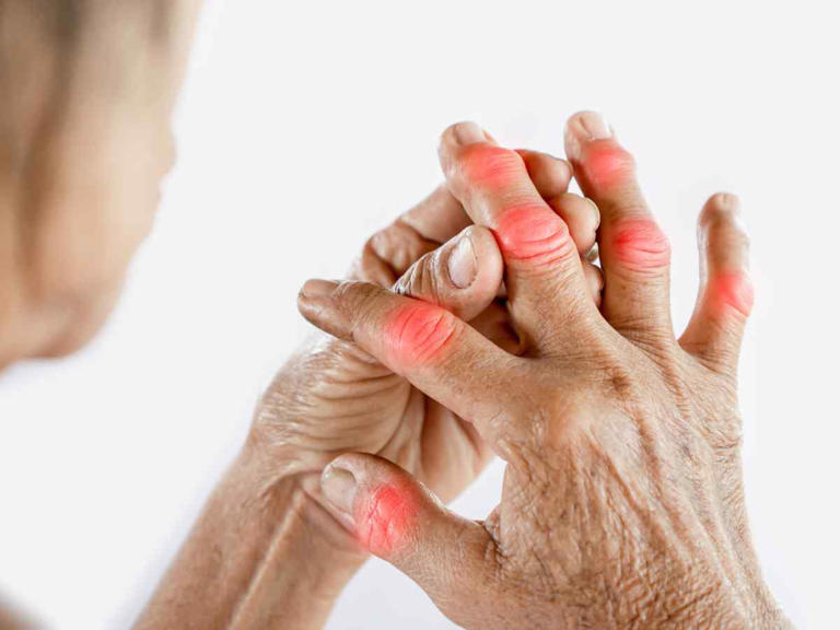 Foto: Cortesía ¿Dolor en las articulaciones? Estas enfermedades podrían estar detrás de las molestias
