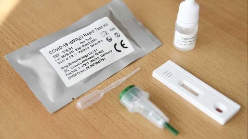 Foto: Cortesía Escándalo por defectuosos productos chinos para el coronavirus en Europa