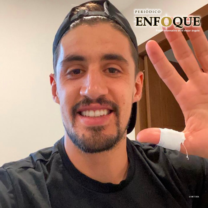Foto: Cortesía Se lesionó dedo de la mano y lo dan de baja de la #eLigaMX