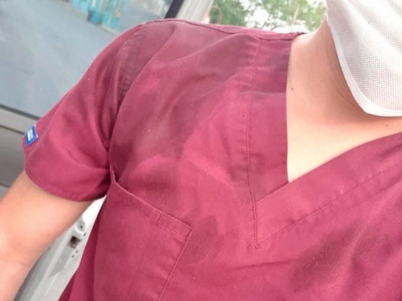 Foto: Cortesía Continúan las agresiones; le arrojan café hirviendo a enfermero de Guadalajara