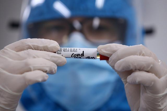 Foto: Cortesía Investigadores detectan en Hong Kong primer caso de reinfección de COVID-19 en el mundo