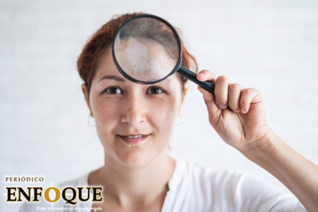 Foto: Cortesía Manchas en la cara: causas, tipos y tratamientos