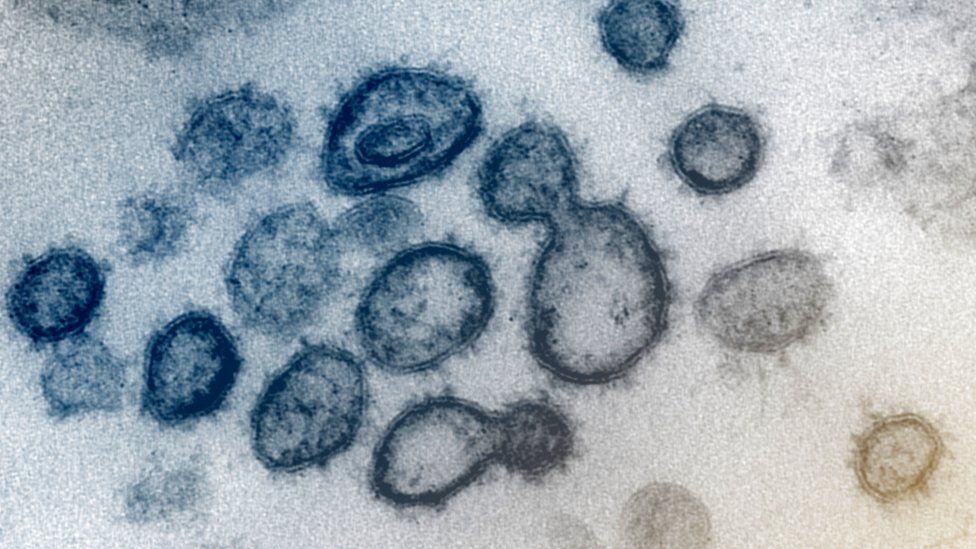Foto: Cortesía Coronavirus: las imágenes microscópicas que revelan detalles del virus que tiene en alerta al mundo