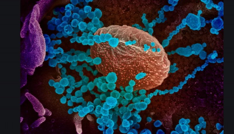 Foto: Cortesía Estas son las diferencias y tratamientos que debes saber entre coronavirus y gripe