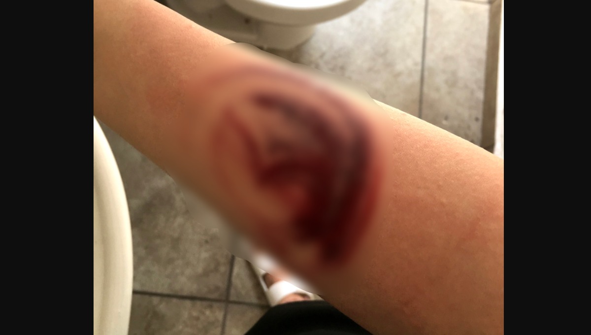 Mujer choca y se le queda "estampado" el logo de su auto (Fotos)