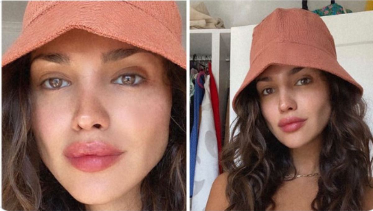 Foto: Cortesía Eiza González se realiza nuevo retoque estético y le llueven críticas