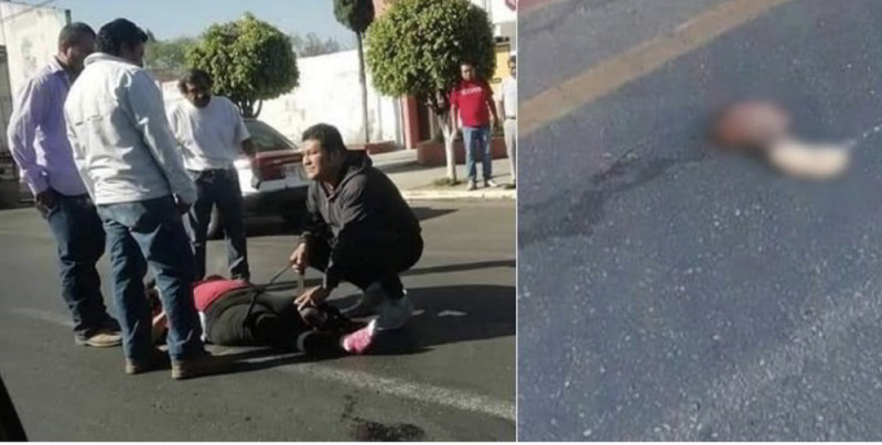 Foto: Cortesía Motociclista viajando a exceso de velocidad atropella a mujer y cercenando su pierna