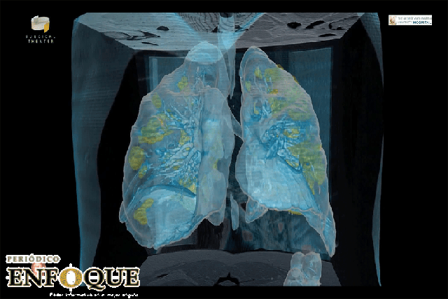 Foto: Cortesía Video en 3D muestra cómo ataca el covid-19 a los pulmones