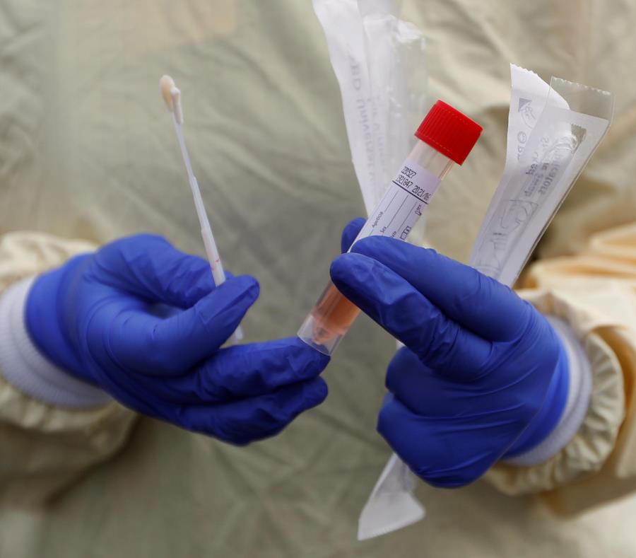 Esto es lo que sabemos de las pruebas rápidas para detectar COVID-19