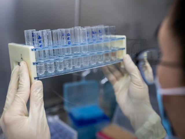 Foto: Cortesía Desarrollan en Japón anticuerpo para combatir al nuevo coronavirus