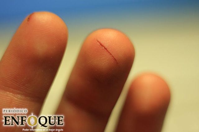 Foto: Cortesía ¿Por qué cortarse con papel duele mucho?