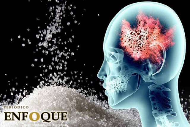 Foto: Cortesía ¿Cómo afecta la azúcar a tu cerebro?
