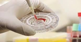 Foto: Cortesía ¿Qué es el virus Chapare, el misterioso patógeno reportado en Bolivia?