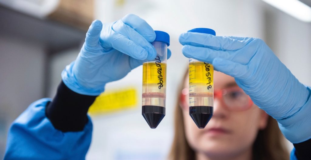 Foto: Cortesía Vacuna de AstraZeneca tuvo un error de manufactura que plantea dudas sobre sus resultados