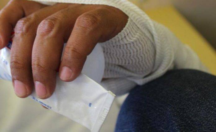 Foto: Cortesía Registran cinco casos de lepra en Yucatán y Quintana Roo