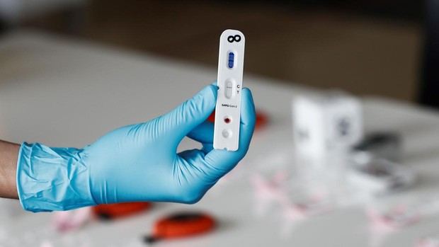Foto: Cortesía Oxford evalúa nueva prueba para detectar a pacientes asintomáticos con COVID-19