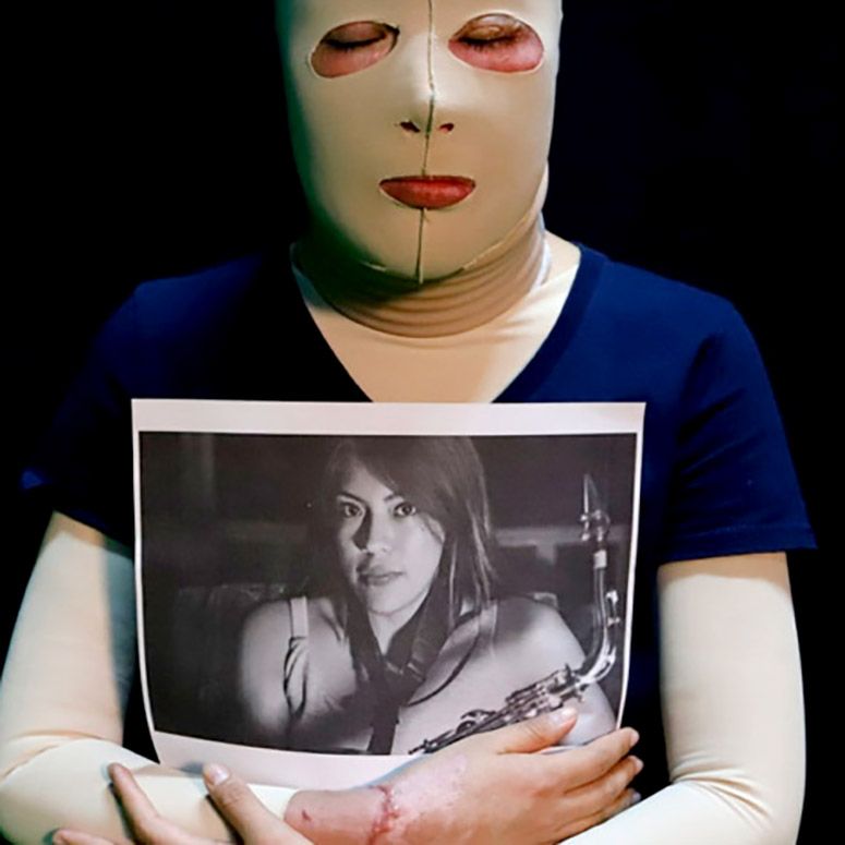 Foto: Cortesía A un año de ataque con ácido, la última orden de aprehensión sigue sin ejecutarse: Elena Ríos