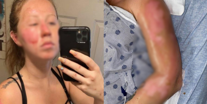 Por: Cortesía Queman rostro de chica con bebida flamante en un bar en Cancún