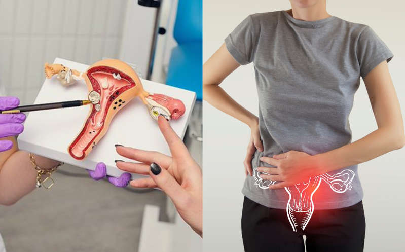 Por: Cortesía Incrementan casos de cáncer cervicouterino en mujeres de entre 25 y 35 años