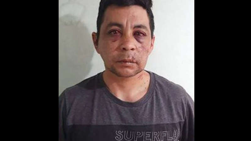 Por: Cortesía Enfermero fallece tras ser golpeado brutalmente por sus vecinos al enterarse que tenía COVID-19