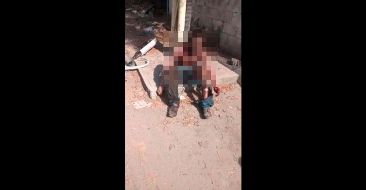 Por: Cortesía Hombre recibe descarga eléctrica de 7 mil 500 voltios tras intentar robar lámpara de alumbrado público en Puebla