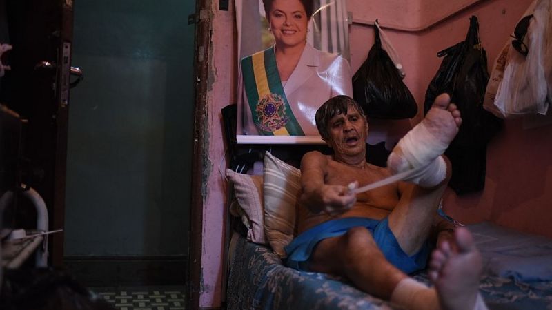 Foto: Cortesía En qué países sigue habiendo lepra (y por qué no se ha logrado erradicar)