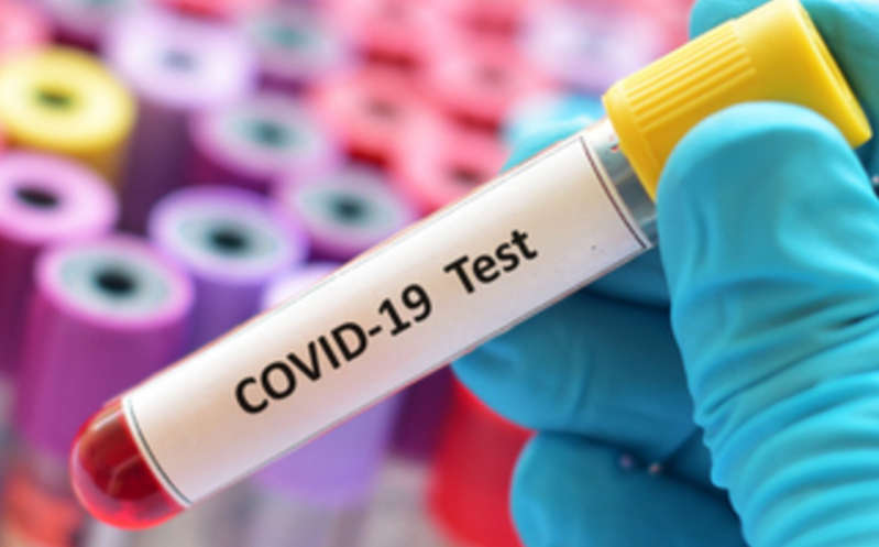 Por: Cortesía ¿Podrías contagiarte de covid-19 grave? Estudio de sangre podría dar respuesta