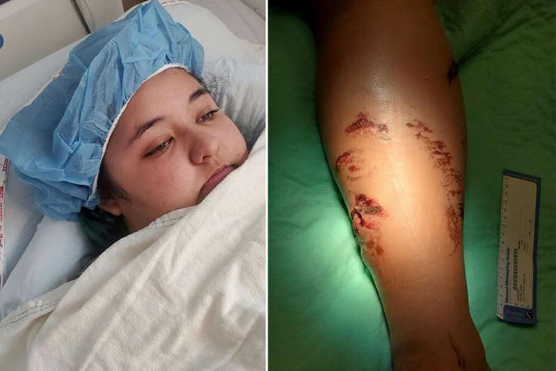 Por: Cortesía Atacan a joven estadounidense por un cocodrilo en playas mexicanas