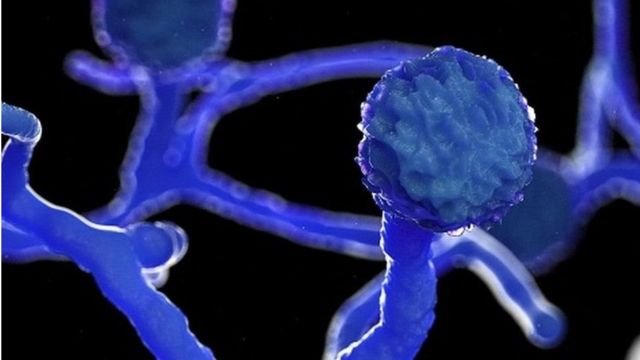 Por: Cortesía ¿Qué es la mucormicosis o el hongo negro? Conoce los síntomas