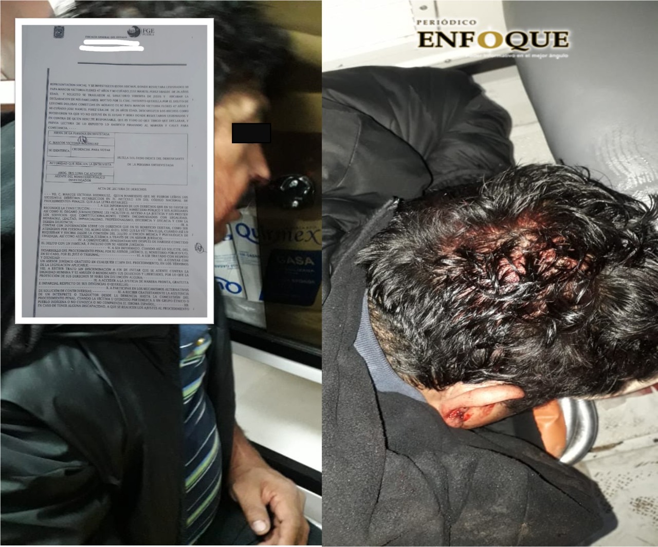 Por: Cortesía Acusan a equipo de Joel Martínez de Morena de agredir a simpatizantes del PES en Cuapiaxtla; uno de ellos se debate entre la vida y la muerte (video)