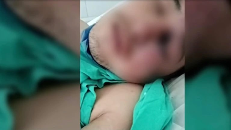 Por: Cortesía Familia de Gregorio, el paciente fallecido sospechoso de hongo negro, denunció que tardaron varios días para operarlo
