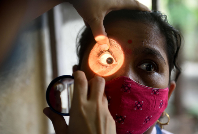 Por: Cortesía México registra primera muerte por mucormicosis, la enfermedad del ´Hongo Negro´