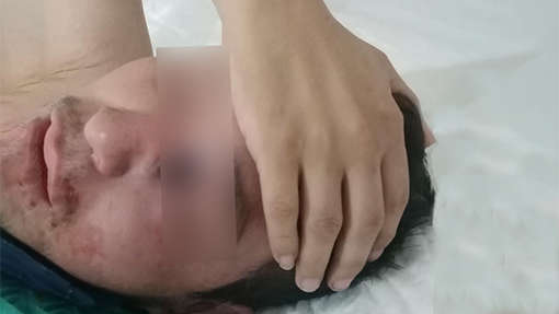 Por: Cortesía En Oaxaca, mujer que se contagió de 'hongo negro' se encuentra grave en el hospital