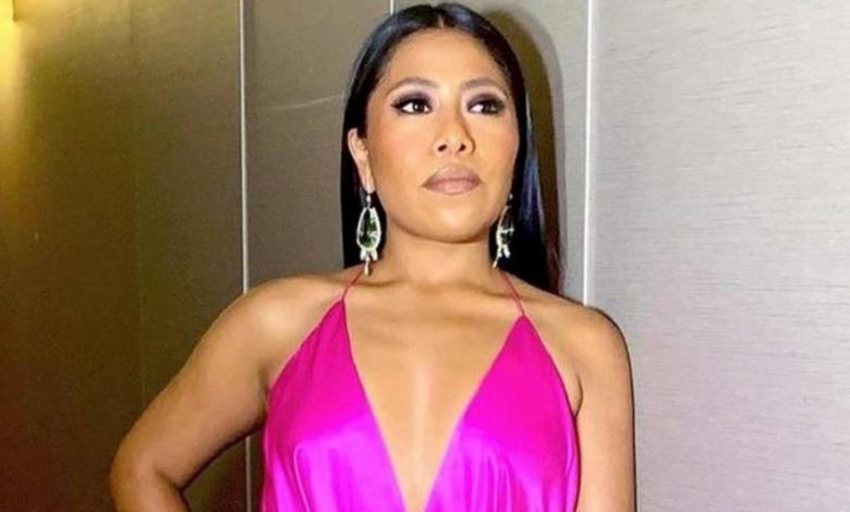 Foto: Cortesía Melasma, la enfermedad incurable que padece Yalitza Aparicio tras aparecer en “Roma”