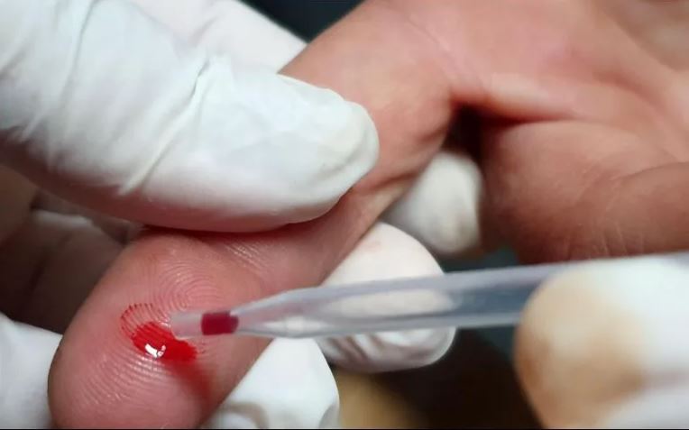 El Sida cumple 40 años con casos y muertes a la baja, pero lejos de su final