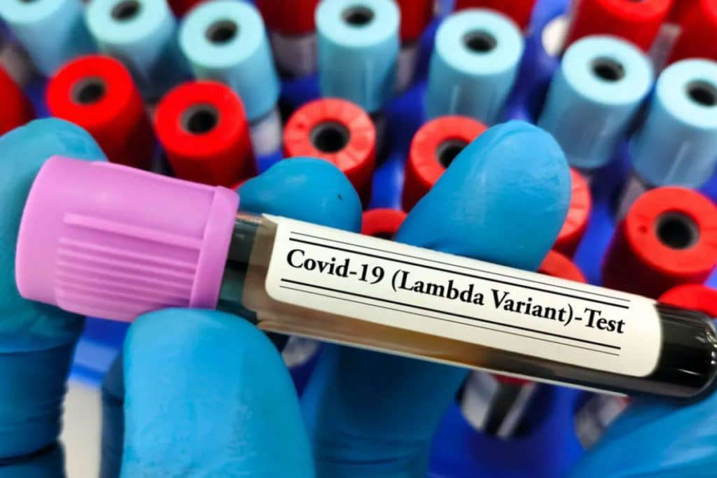 Por: Cortesía Detectan la variante Lambda de Covid 19 en Oaxaca